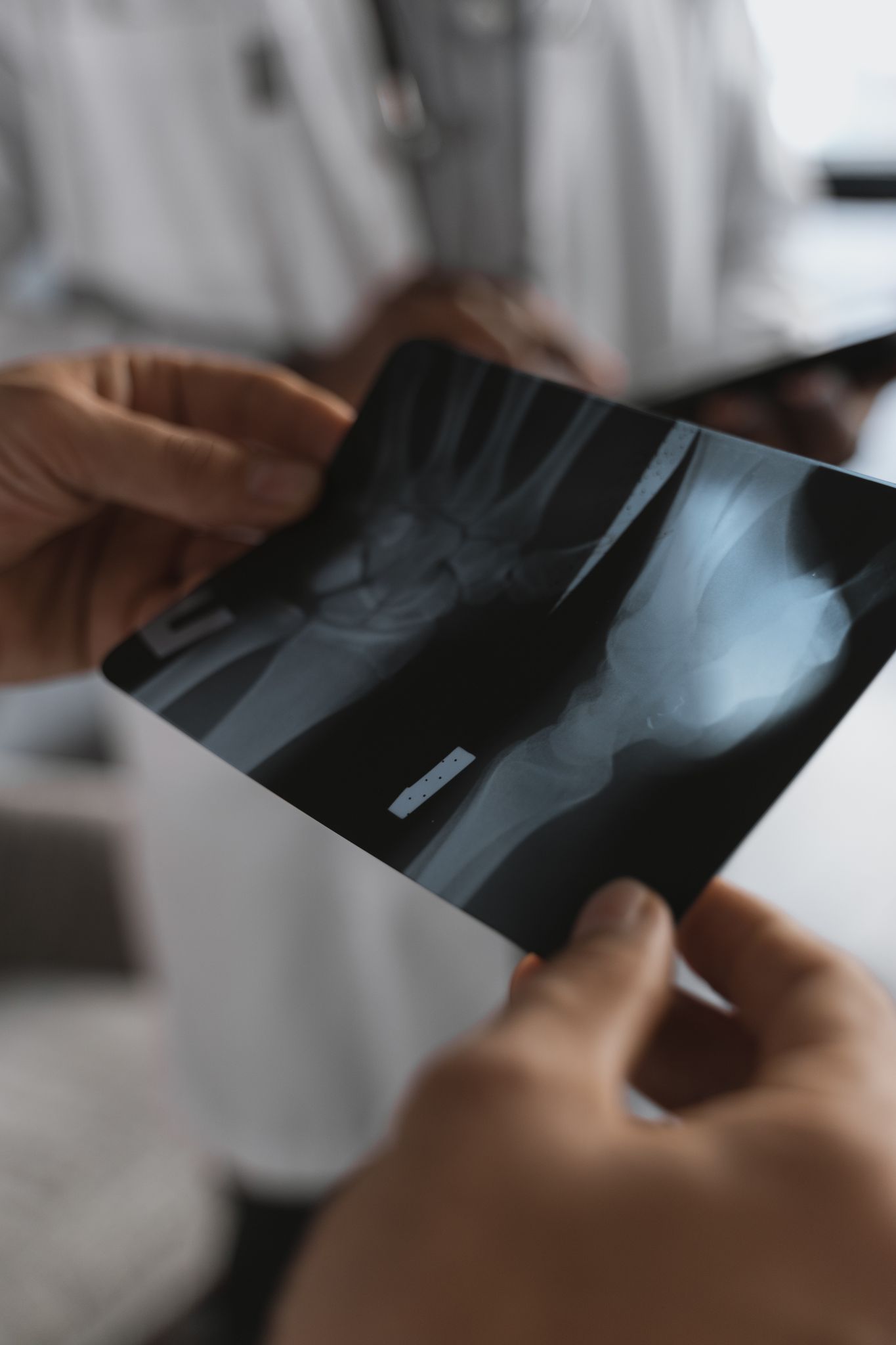 Close-up of hands holding an X-ray image in a medical environment with healthcare professionals.